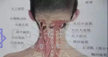 后脑勺的机关——头痛头晕治疗点插图15